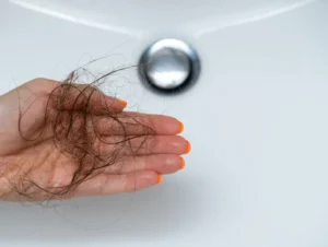 Hand holding clump of hair over sink.